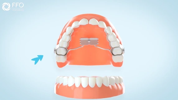 Orthodontiste à Thionville, Docteur Catherine Py : сomment activer le disjoncteur