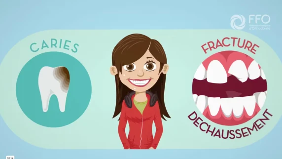 Les astuces importantes en orthodontie