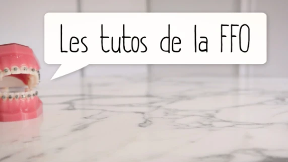Le tutoriel comment éviter de casser l'appareil orthodontique