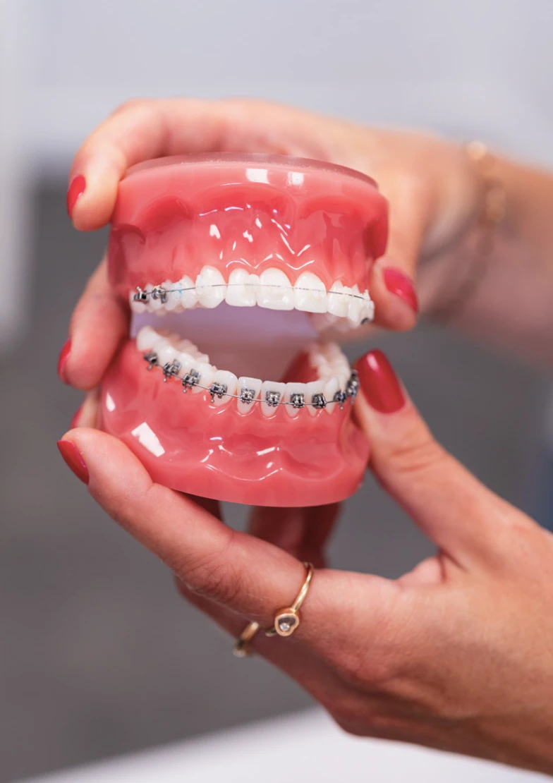 Un exemple illustratif des multi-bagues au Cabinet d'orthodontie du Docteur Py